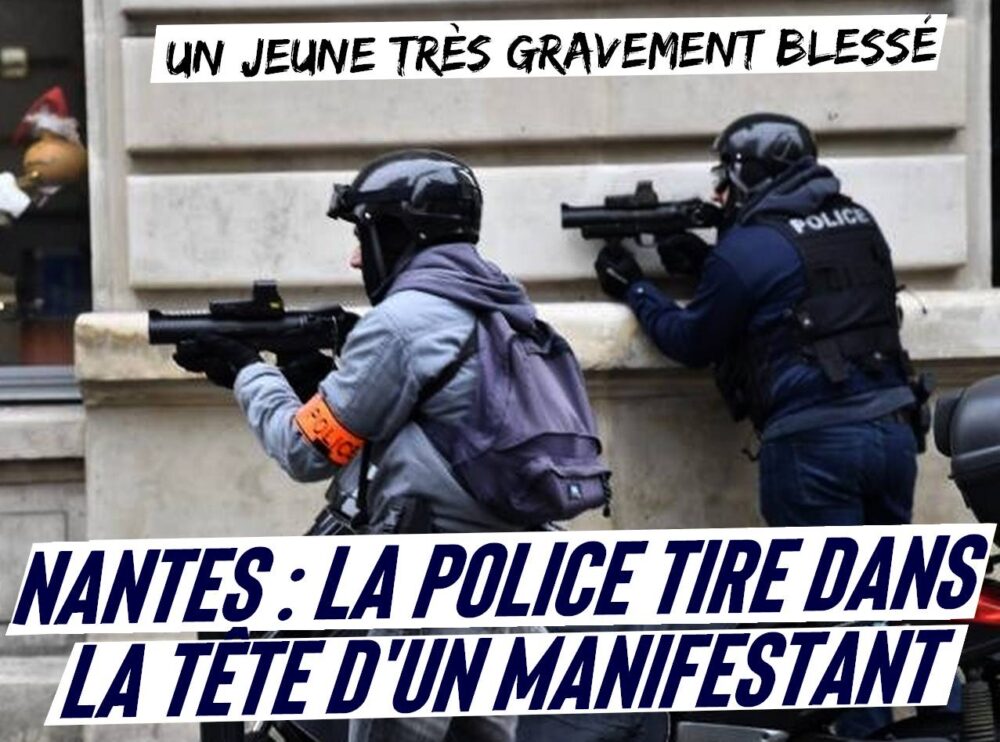 Nantes : la police blesse très gravement un manifestant