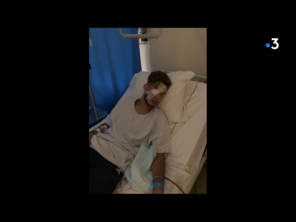 Lyon : violences racistes et répression le soir de la victoire de l’Algérie