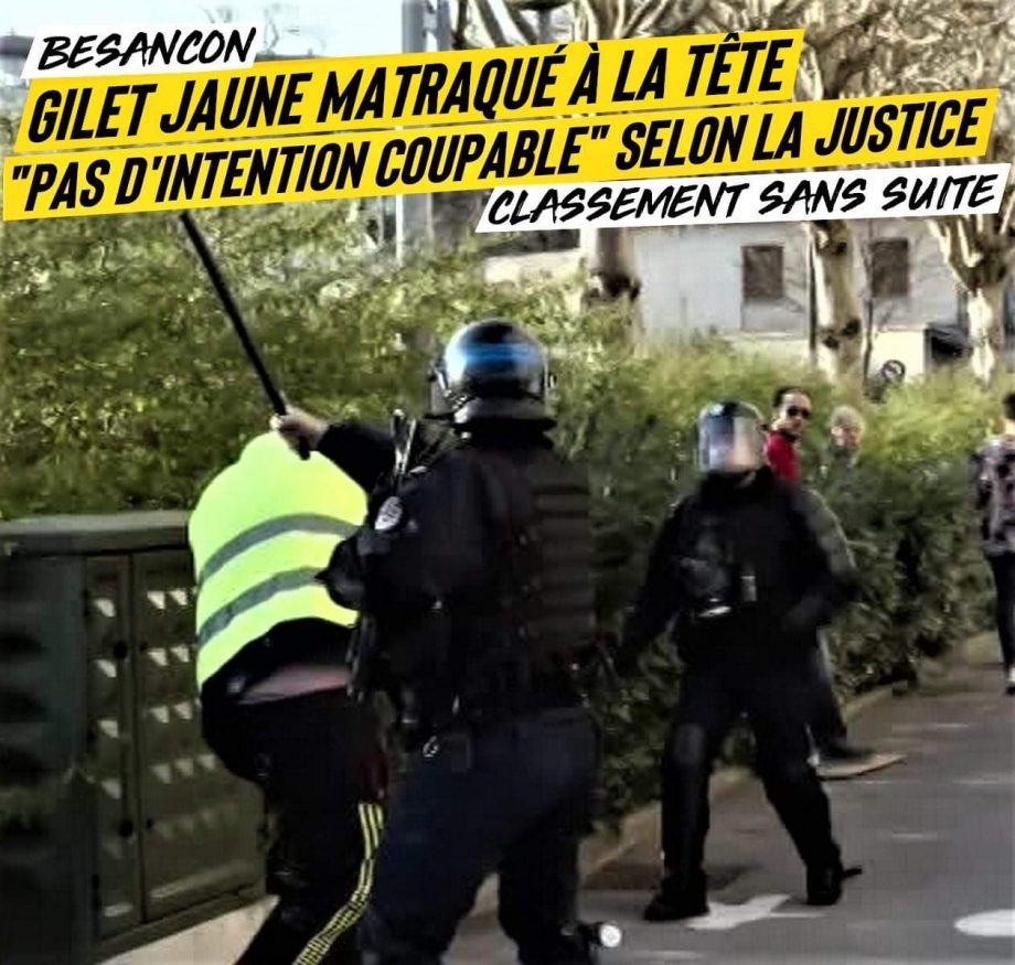 Gilet Jaune matraqué à la tête : « pas d’intention coupable » selon la justice