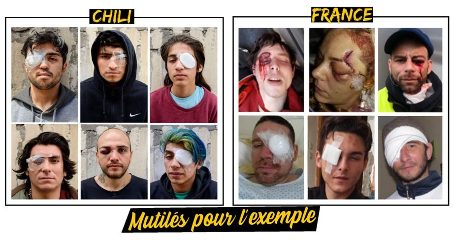 Mutilés pour l’exemple à Santiago comme à Paris
