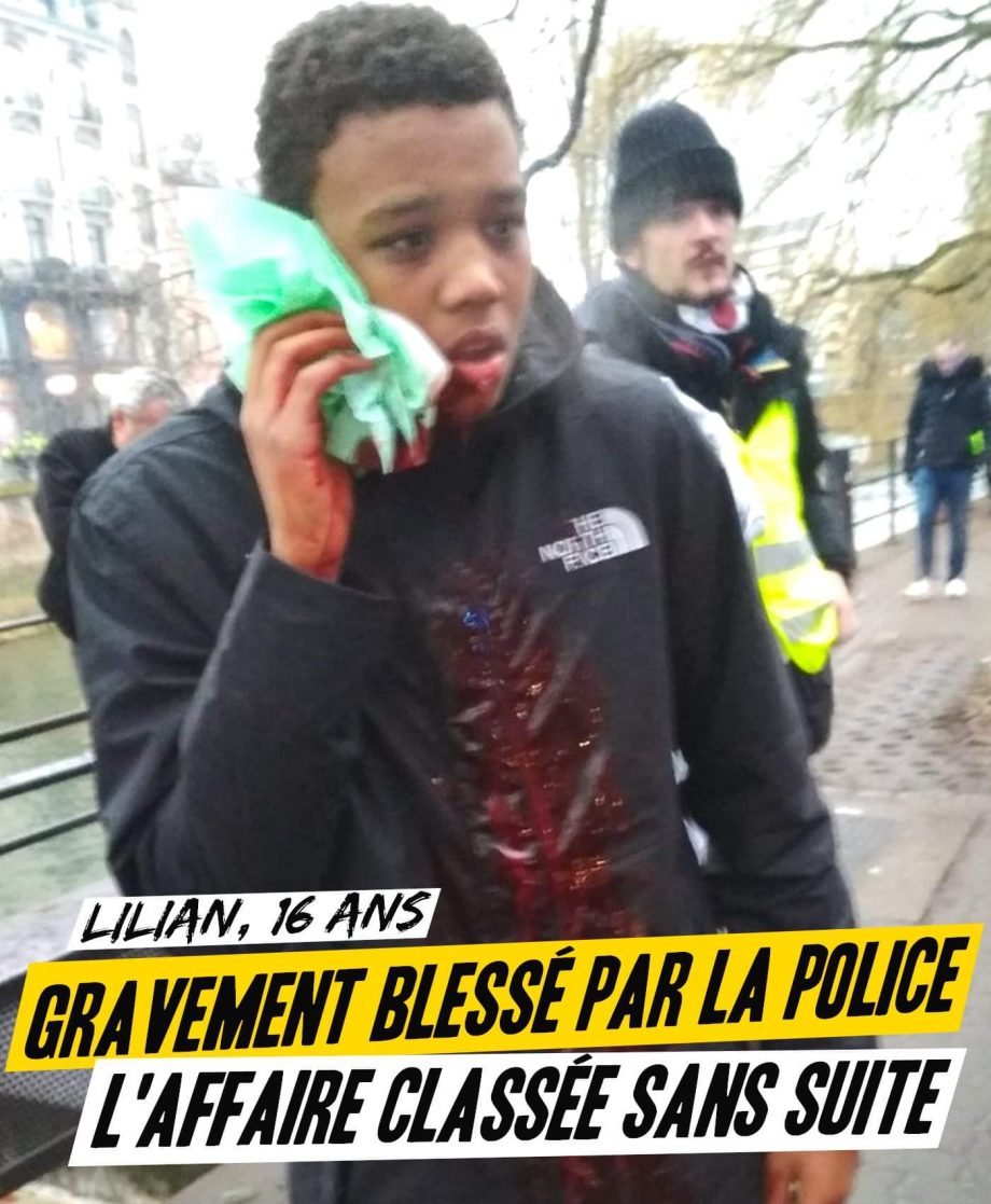 Lilian, 15 ans, gravement blessé par un tir policier : affaire classée