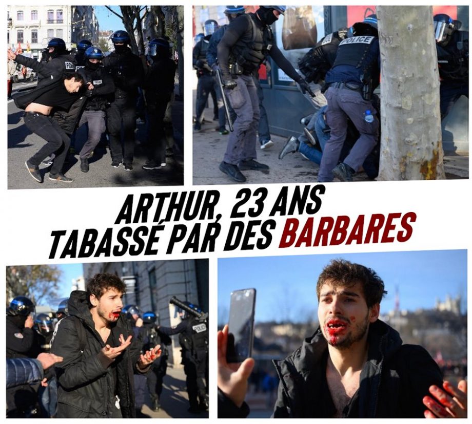 Lyon : Arthur, 23 ans, tabassé par des barbares