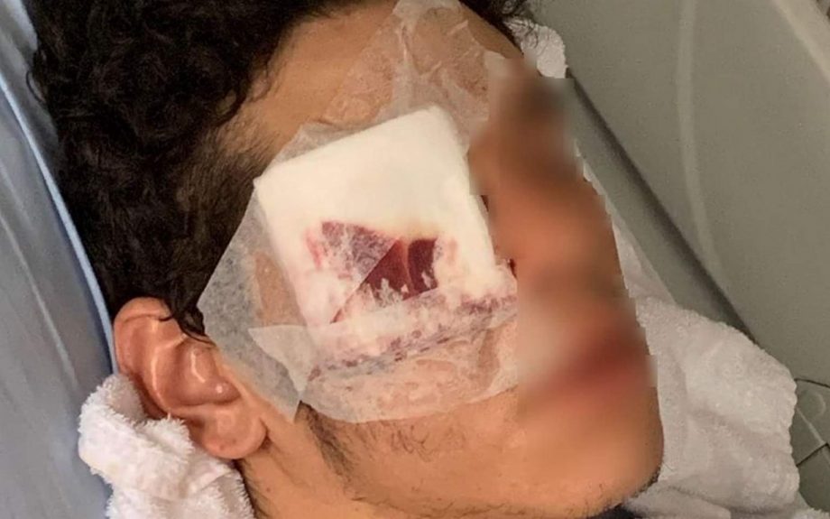 Adnane, 19 ans, mutilé par la police