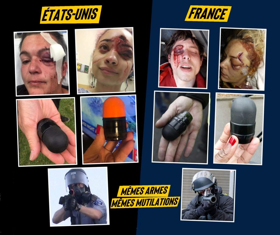 États-Unis / France : la police mutile