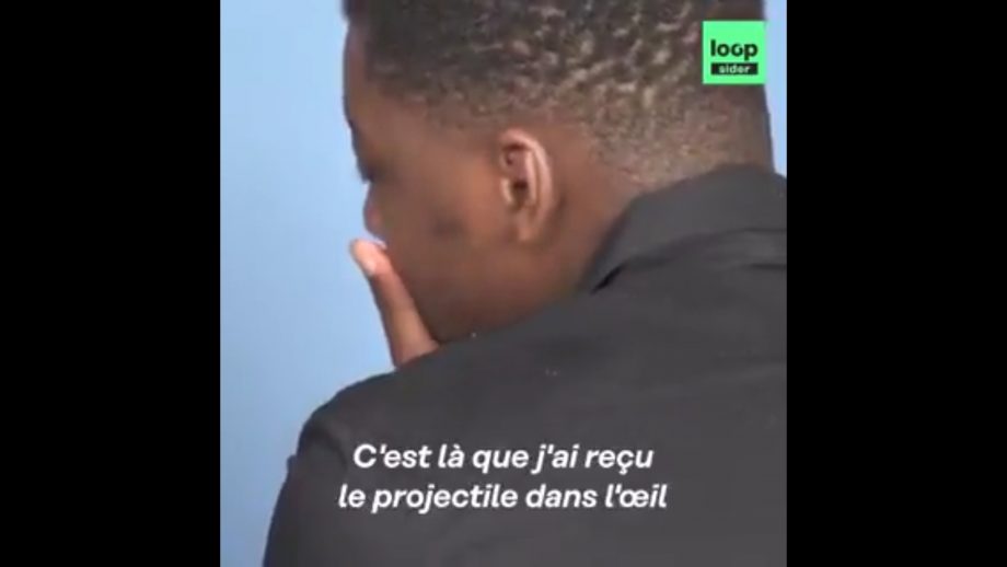 Santo, éborgné à la manifestation du 13 juin dernier à Paris