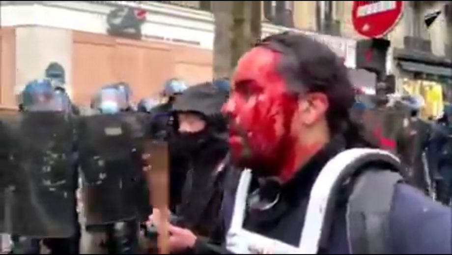Paris : carnage répressif