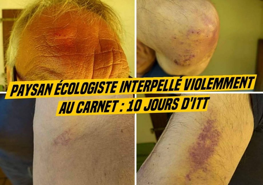 Paysan interpelé violemment au Carnet : 10 jours d’ITT
