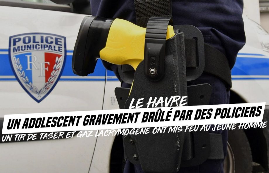 Le Havre : un adolescent gravement brûlé par des policiers