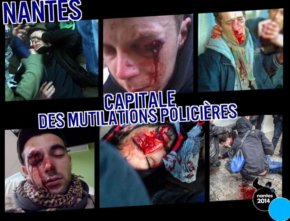 Nantes : capitale des mutilations policières