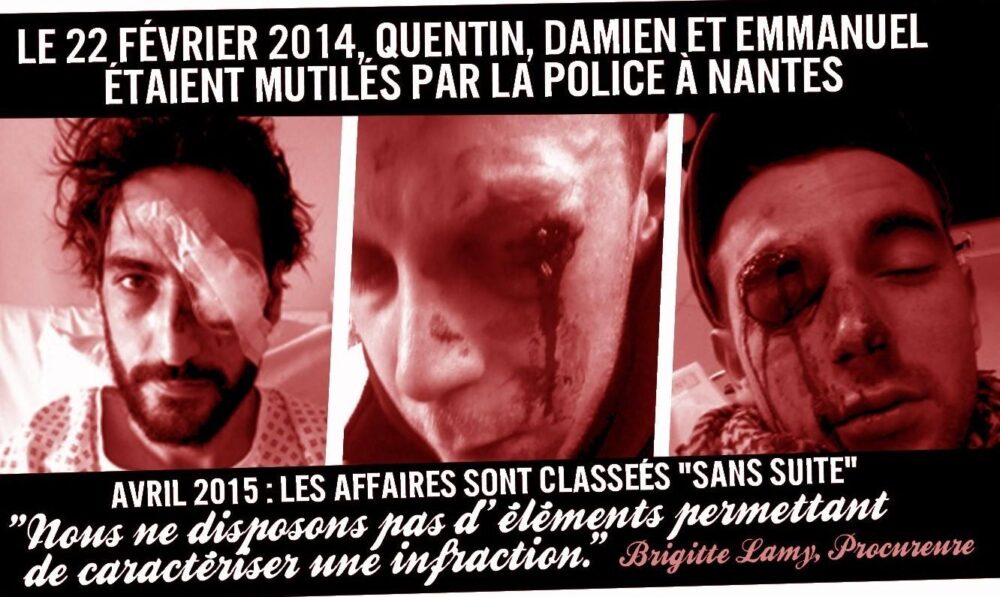 Les mutilations du 22 février classées sans suite