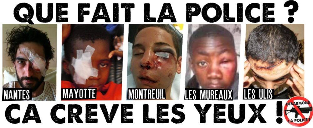 Que fait la police ? Ça crève les yeux !