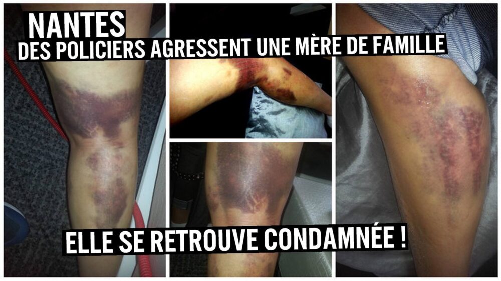 Nantes : des policiers agressent une mère de famille, elle se retrouve condamnée !