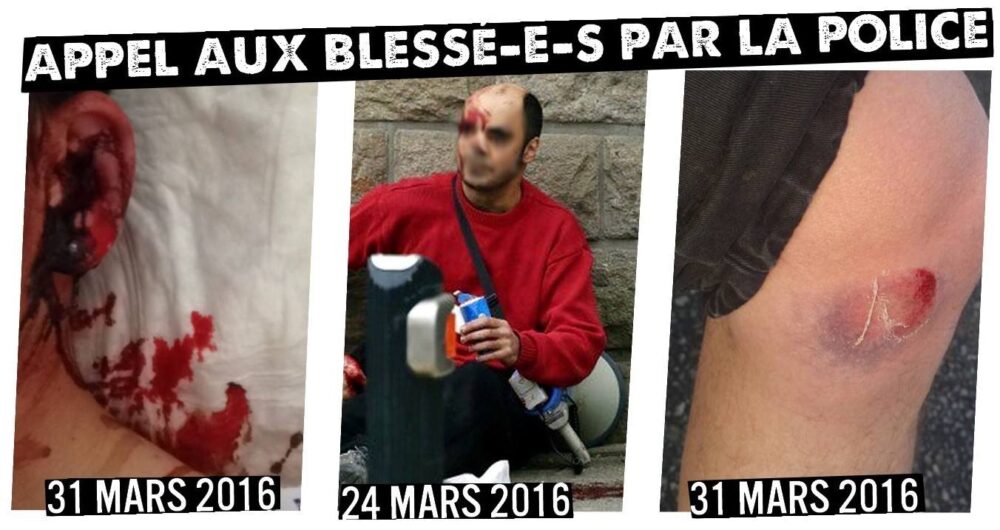 Nantes : appel aux blessé-­e­-s suite aux manifestations