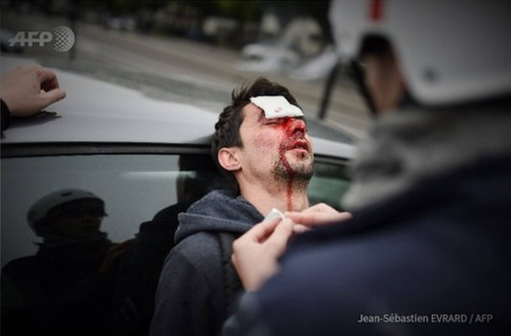 À chaud : violence à Nantes