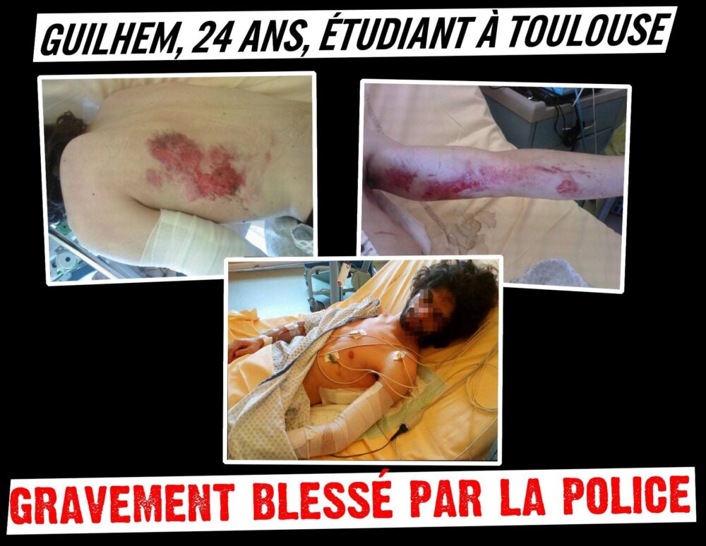 Guilhem, 24 ans, étudiant à Toulouse, gravement blessé par la police