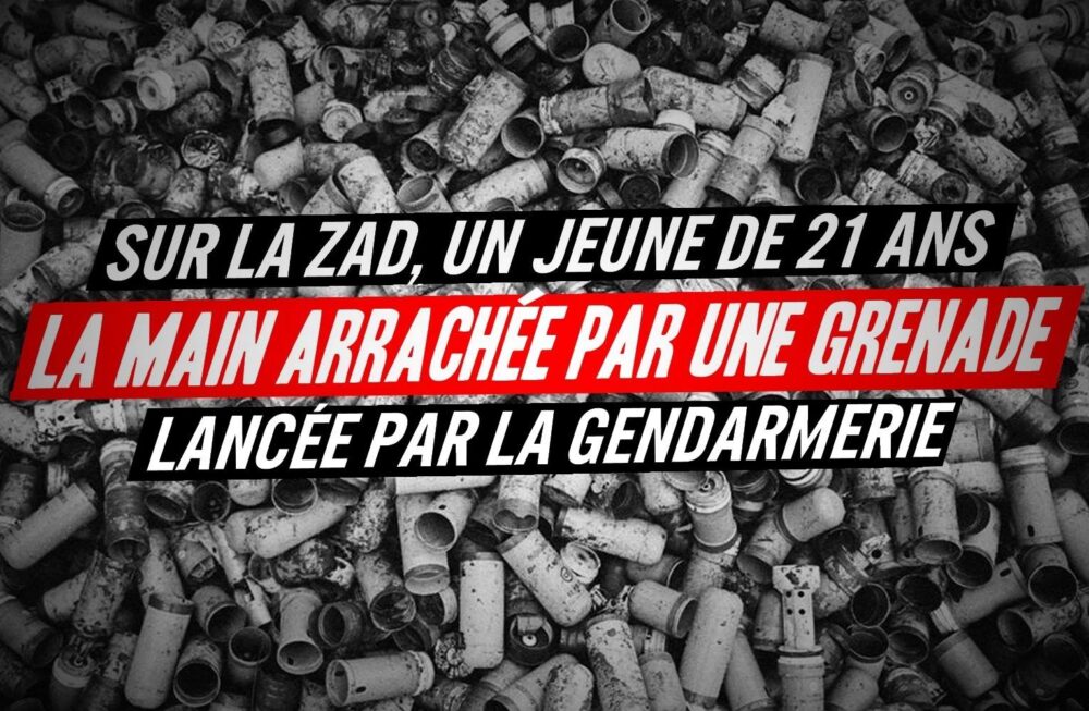 Sur la ZAD : la main arrachée par une grenade