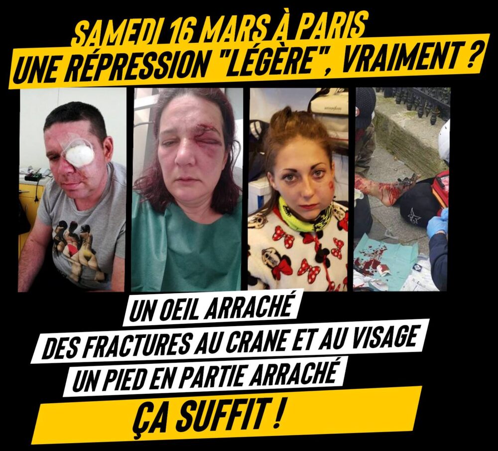 Désintox – À Paris le 16 mars, une répression « légère », vraiment ?