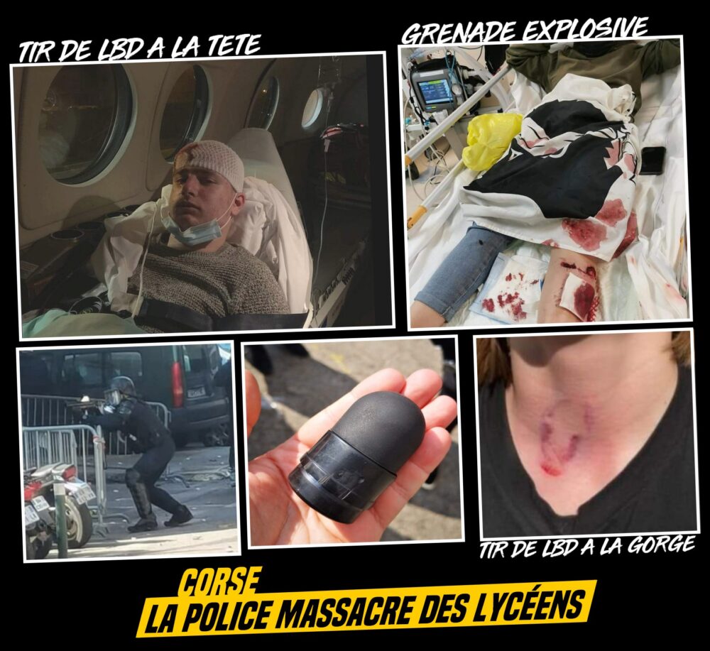 Corse : la police massacre des lycéen.ne.s