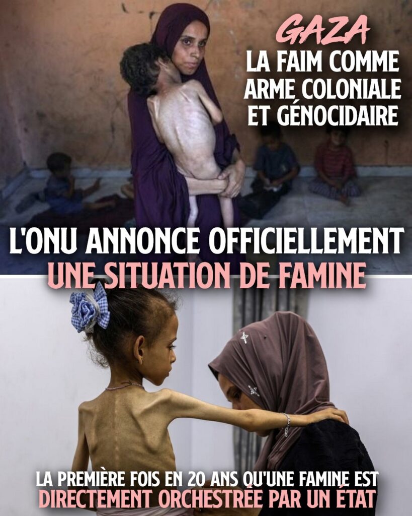 Deux images déchirantes d'enfants décharnés à cause de la famine qui règne à Gaza