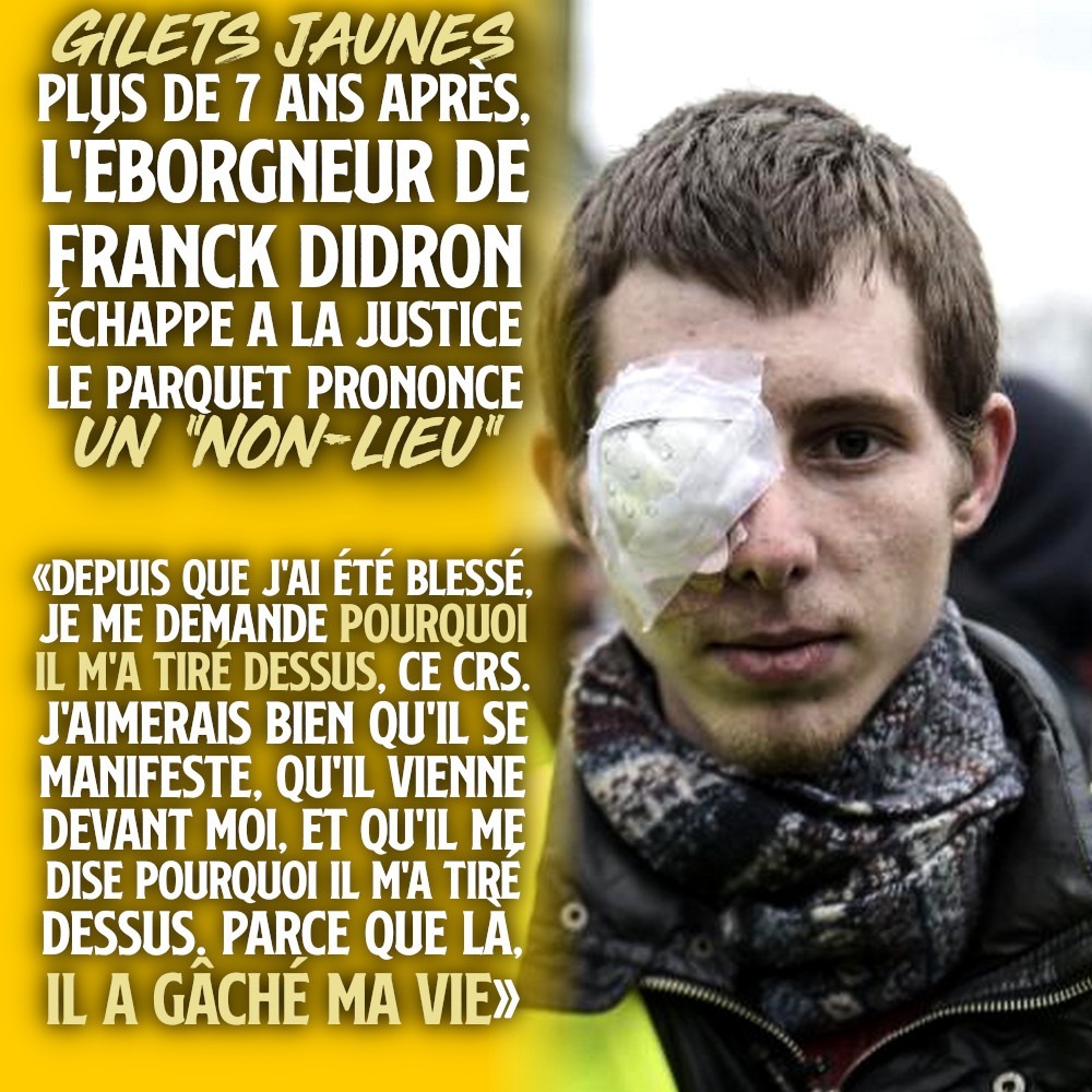 Franck Didron, un pansement sur l'œil après avoir été éborgné par un policier qui restera impuni.