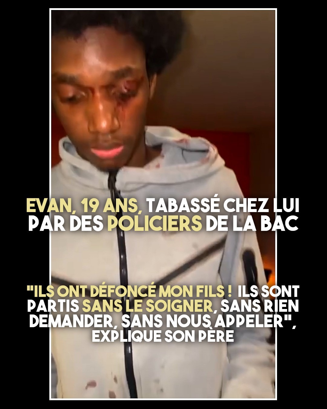 Une photo d'Evan, jeune homme noir tabassé par des policiers, chez lui, à cause d'une coupure de courant et d'un voisin délateur