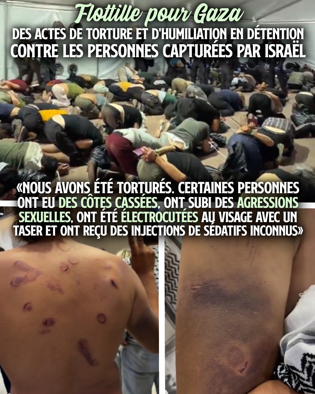Des positions douloureuses et de nombreuses marques de coups sur les corps : les membres de la flottille pour Gaza ont été torturés par l'État d'Israël.