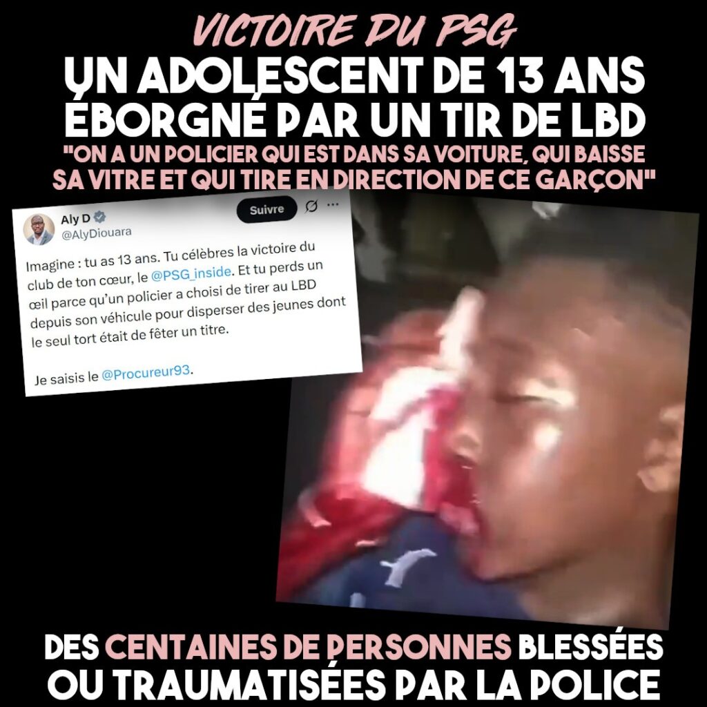 Un mineur blessé à l'œil par un tir de LBD pour avoir fêté la victoire du PSG
