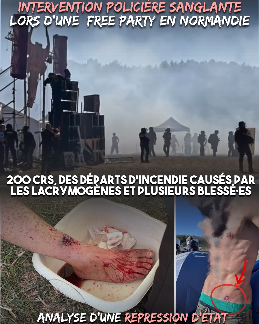 Des lacrymos partout et des trous dans la peau de gens qui dansaient : avec la loi RIPOST, la répression des free partys ne connaît plus de limites.