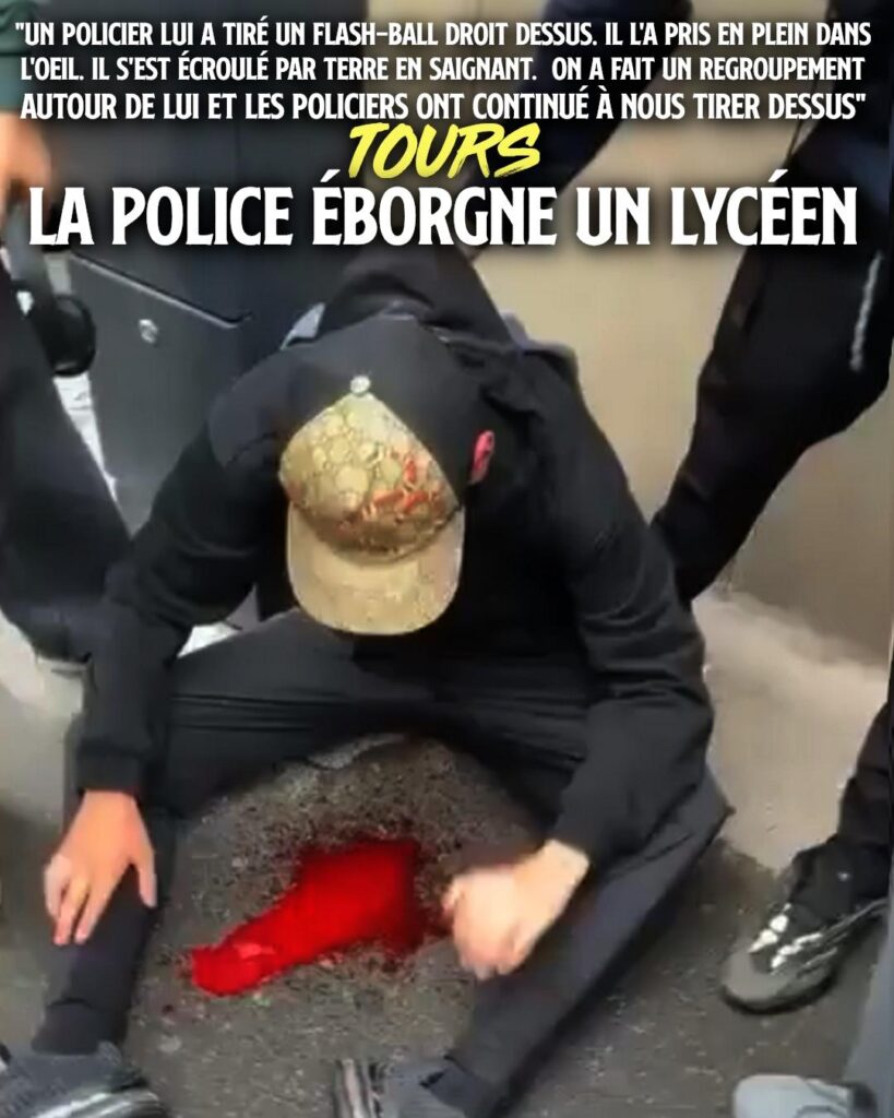Un jeune homme hagard, assis par terre dans une marre de sang : à Tours, ce lycéen a pris une balle de LBD dans l'œil.