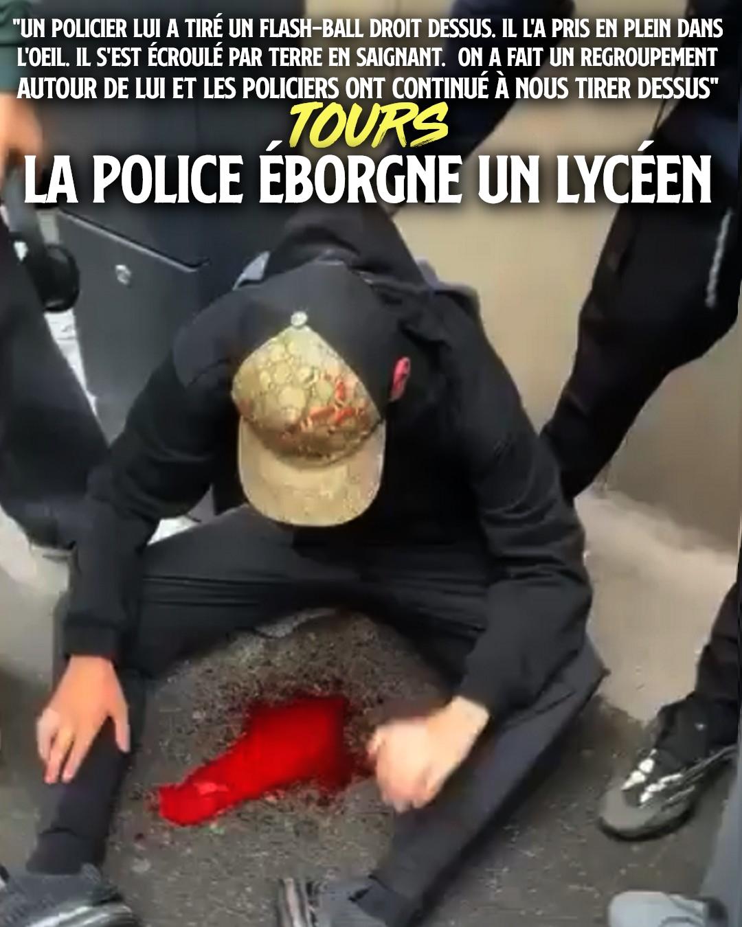 Un jeune homme hagard, assis par terre dans une marre de sang : à Tours, ce lycéen a pris une balle de LBD dans l'œil.