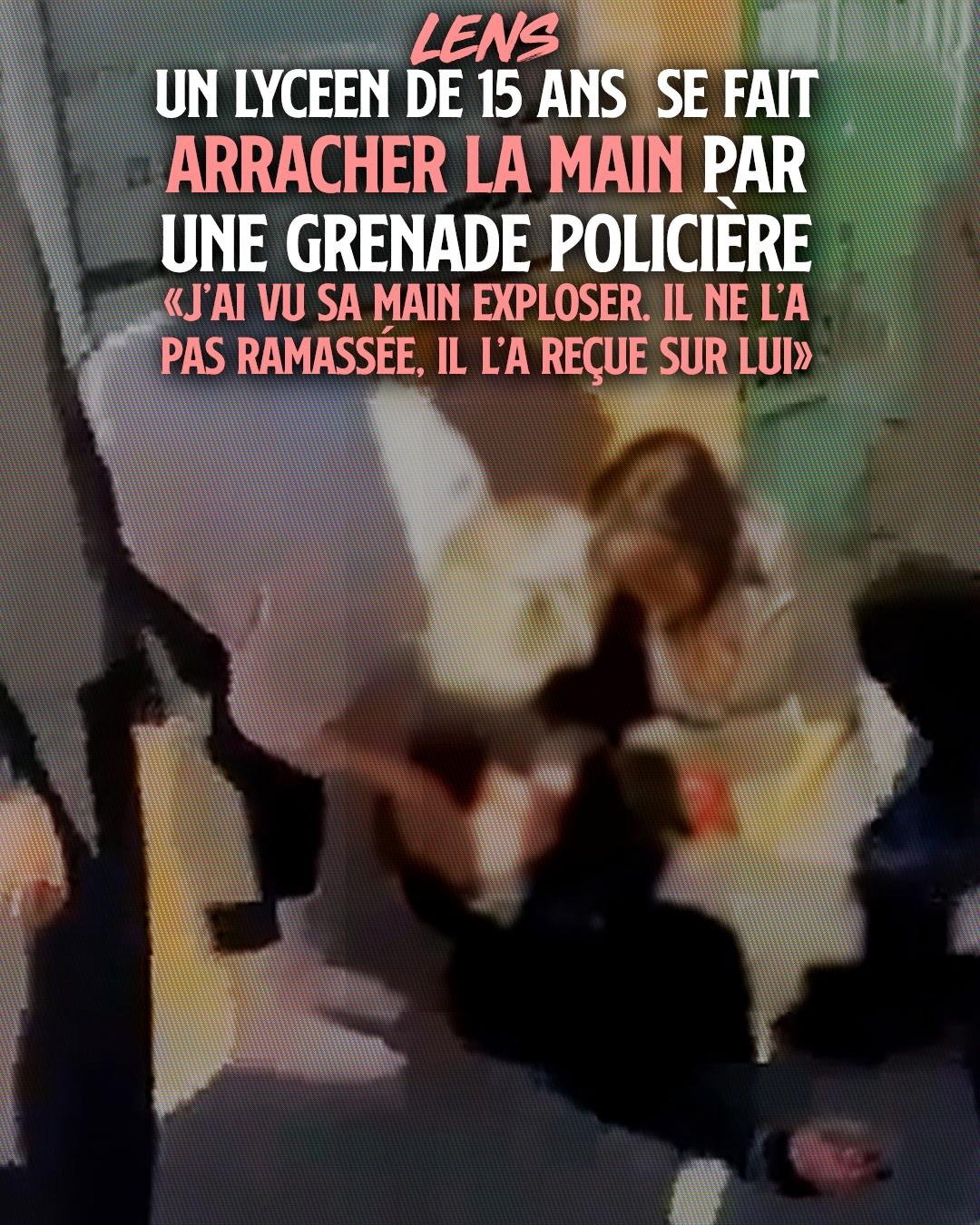 Un jeune avec un moignon à la place de la main : c'est le résultat des violences policières de ce matin à Lens.