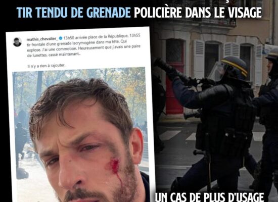 Le champion de MMA Mathis Chevalier poste une photo de lui le visage tuméfié sur les réseaux : il a été touché par un tir tendu de grenade avant même le début de la manifestation.