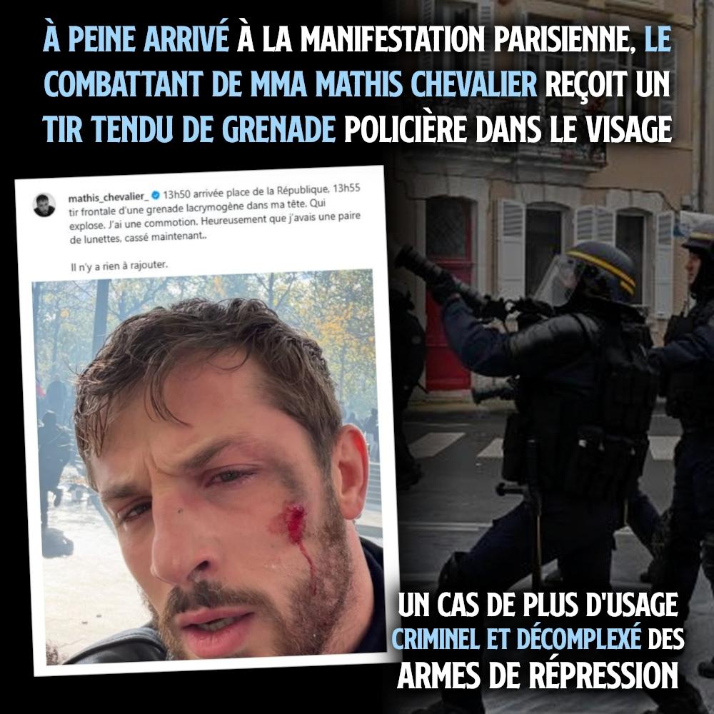 Le champion de MMA Mathis Chevalier poste une photo de lui le visage tuméfié sur les réseaux : il a été touché par un tir tendu de grenade avant même le début de la manifestation.
