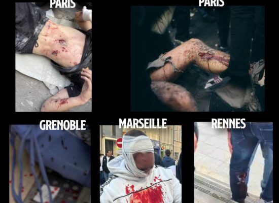 Quelques images des blessures graves infligées par la police ce 17 octobre