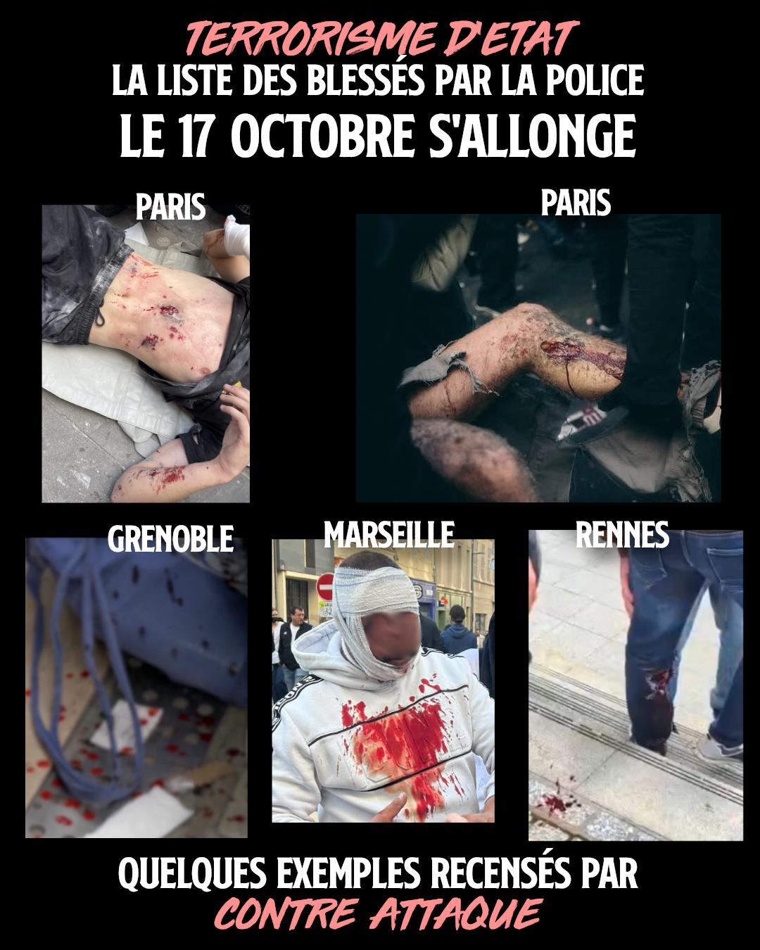 Quelques images des blessures graves infligées par la police ce 17 octobre