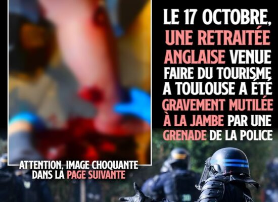 L'image floutée de la jambe d'une touriste anglaise, partiellement arrachée par une grenade policière ce 17 octobre à Toulouse.