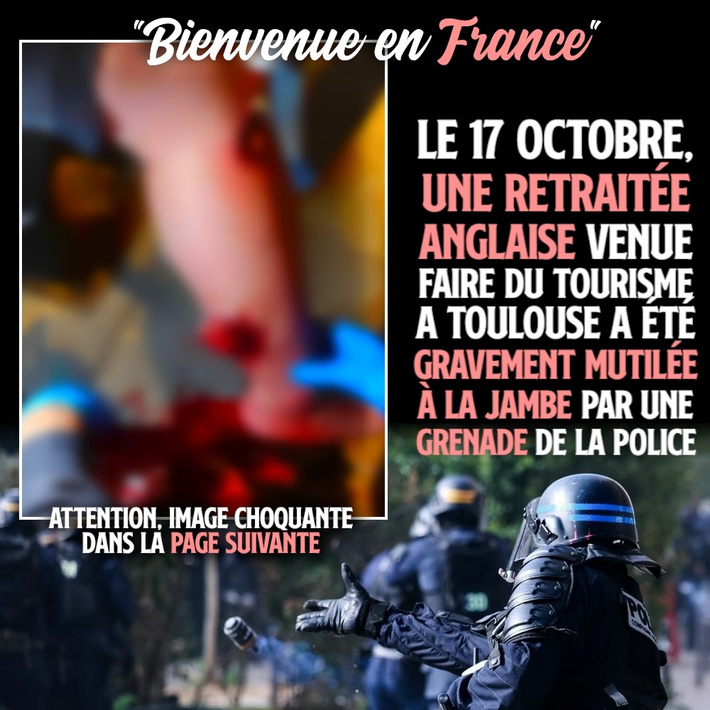 L'image floutée de la jambe d'une touriste anglaise, partiellement arrachée par une grenade policière ce 17 octobre à Toulouse.