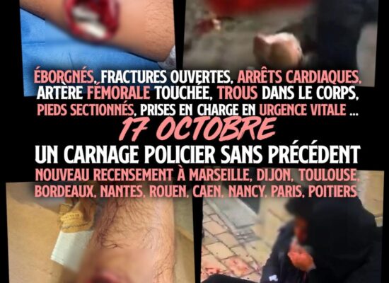 Quelques-unes des blessures d'une gravité sans précédent infligées ce 17 octobre par la police française à sa population.