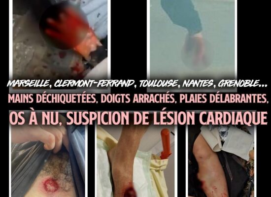 Quelques unes des terribles blessures infligées par la police en ce mois d'octobre.