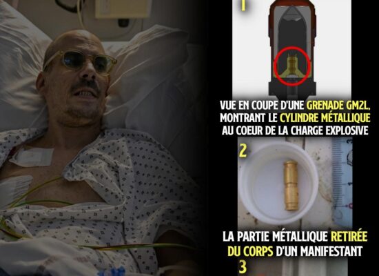 Jonathan sur son lit d'hôpital à cause d'un éclat de grenade qui s'est logé près de son cœur, alors que ce lyonnais voulait juste aller chercher à manger ce 24 octobre.